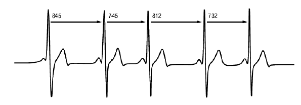 What is Heart Rate Variability?